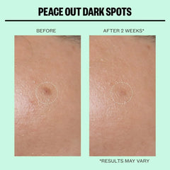 Peace Out- Dark Spots Micro Needling Dots - The Beauty League Pakistan