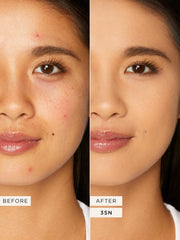 Tarte- shape tape™ full-coverage concealer- 35N Medium - The Beauty League Pakistan