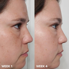 Paula's Choice- SKIN PERFECTING 2% BHA Liquid Exfoliant 118ml - The Beauty League Pakistan