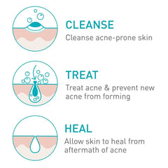 CeraVe- Acne Foaming Cream Cleanser 150ml - The Beauty League Pakistan