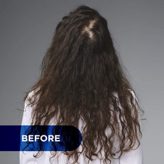 L’Oréal Professional- Serioxyl Denser Hair Serum for Thinning Hair | Daily Scalp Treatment 90 ml