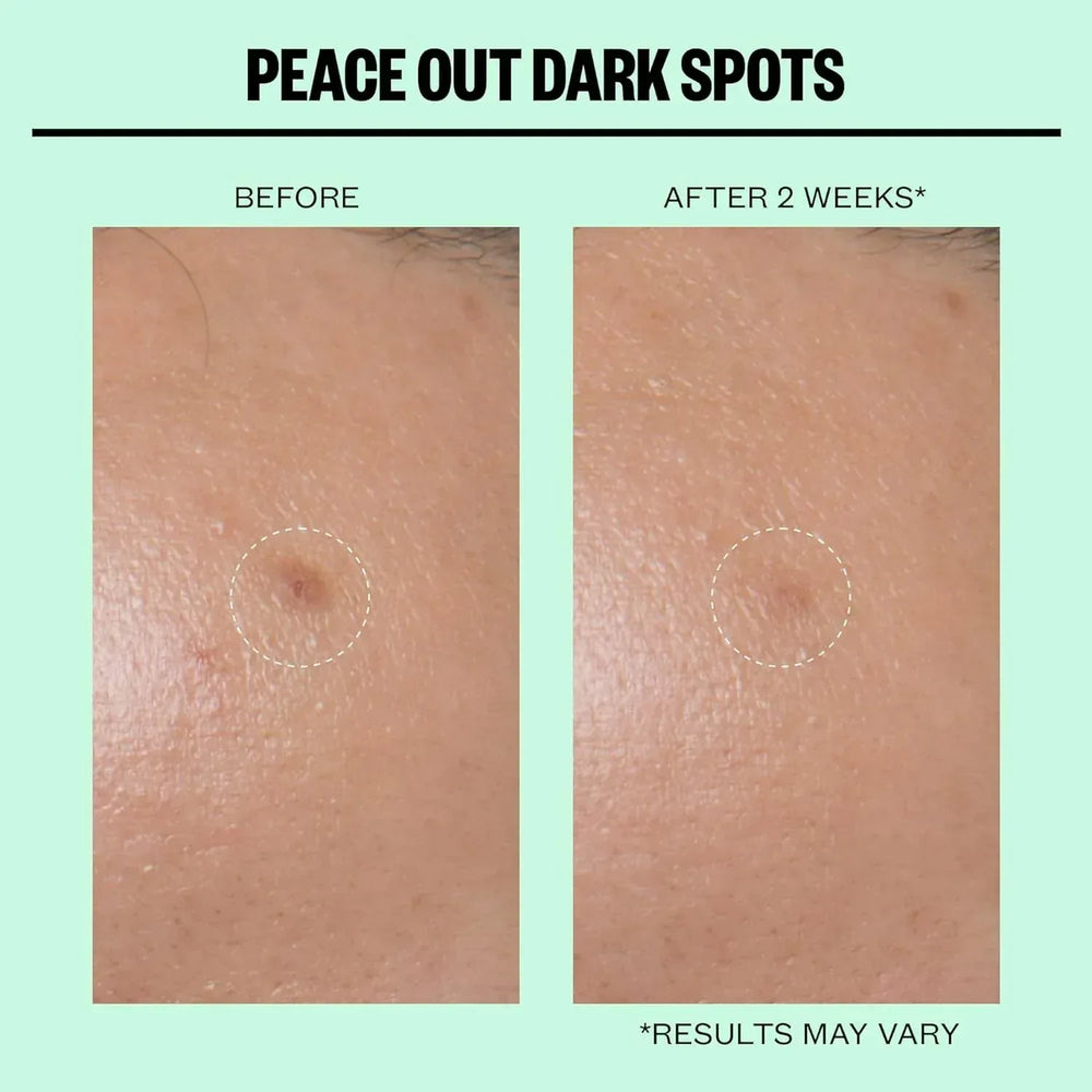 Peace Out- Dark Spots Micro Needling Dots - The Beauty League Pakistan