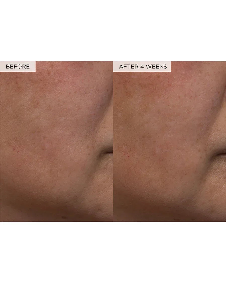 Glow Recipe Watermelon Glow PHA + BHA Pore-Tight Toner- 150ml - The Beauty League Pakistan