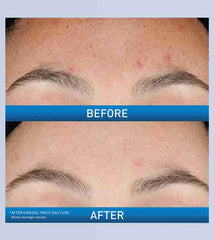 CeraVe- Resurfacing Retinol Serum
