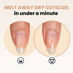 Londontown- Kur Fresh Glow Cuticle Remover