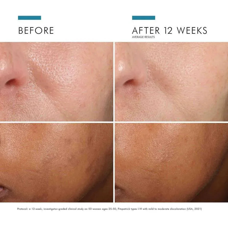 SkinCeuticals- Phloretin CF® With Ferulic Acid - The Beauty League Pakistan